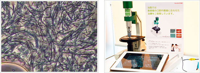 黒いヒモが、位相差顕微鏡から観察されたカビ菌です！